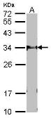Anti-FBXL12 antibody [C2C3], C-term used in Western Blot (WB). GTX104870
