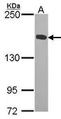Anti-KIF4A antibody [C3], C-term used in Western Blot (WB). GTX104873