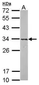 Anti-CLIC4 antibody used in Western Blot (WB). GTX104888