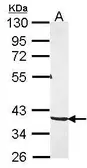 Anti-PKA C gamma antibody [N1C3] used in Western Blot (WB). GTX104895