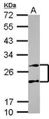 Anti-PSMA4 antibody used in Western Blot (WB). GTX104896