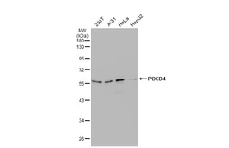 Anti-PDCD4 antibody used in Western Blot (WB). GTX104901