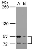 Anti-CD89 antibody used in Western Blot (WB). GTX104902