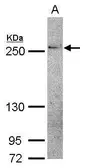 Anti-THADA antibody [C3], C-term used in Western Blot (WB). GTX104909