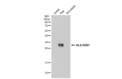 Anti-HLA-DRB1 antibody [N1C3] used in Western Blot (WB). GTX104919