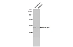 Anti-CYP26B1 antibody [N2C2], Internal used in Western Blot (WB). GTX104932