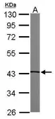 Anti-PKA C alpha antibody [N2C3] used in Western Blot (WB). GTX104934