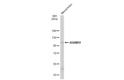 Anti-ADAM10 antibody [N2C1], Internal used in Western Blot (WB). GTX104940