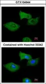 Anti-RGS2 antibody used in Immunocytochemistry/ Immunofluorescence (ICC/IF). GTX104944
