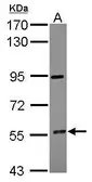 Anti-CYP4F12 antibody used in Western Blot (WB). GTX104951