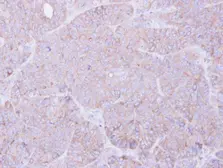 Anti-MOK antibody [N2C3] used in IHC (Paraffin sections) (IHC-P). GTX104958