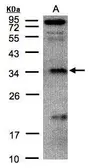 Anti-FN3KRP antibody [N1C2] used in Western Blot (WB). GTX104964