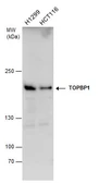 Anti-TOPBP1 antibody [C1C2], Internal used in Western Blot (WB). GTX104978