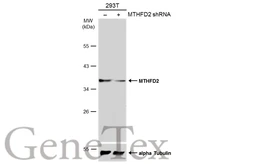 Anti-MTHFD2 antibody [N1C3] used in Western Blot (WB). GTX104990