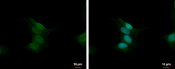 Anti-Calcineurin A antibody used in Immunocytochemistry/ Immunofluorescence (ICC/IF). GTX105003