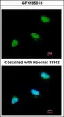 Anti-CDC34 antibody [N1C3] used in Immunocytochemistry/ Immunofluorescence (ICC/IF). GTX105013