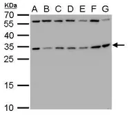 Anti-RPS3A antibody used in Western Blot (WB). GTX105020
