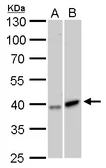 Anti-GALK1 antibody [N3C3] used in Western Blot (WB). GTX105024