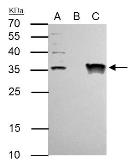 Anti-TFIIE beta antibody used in Immunoprecipitation (IP). GTX105029