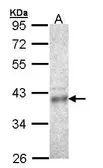 Anti-CPOX antibody [N2C3] used in Western Blot (WB). GTX105056