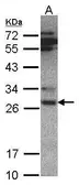 Anti-PSMA6 antibody used in Western Blot (WB). GTX105061