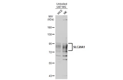 Anti-SLC20A1 antibody [N3C2], Internal used in Western Blot (WB). GTX105062