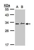 Anti-XRCC2 antibody [N1C3] used in Western Blot (WB). GTX105069