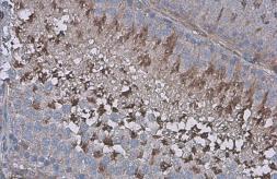 Anti-ZPBP antibody used in IHC (Paraffin sections) (IHC-P). GTX105073