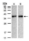 Anti-ZPBP antibody used in Western Blot (WB). GTX105073