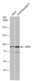 Anti-PiT2 antibody [N2C1], Internal used in Western Blot (WB). GTX105078