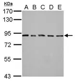 Anti-MAD1 antibody used in Western Blot (WB). GTX105079