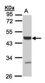 Anti-UST antibody [N1C3] used in Western Blot (WB). GTX105084
