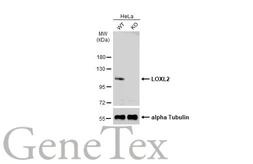 Anti-LOXL2 antibody used in Western Blot (WB). GTX105085