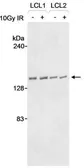 Anti-RENT1 antibody used in Western Blot (WB). GTX10510