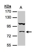 Anti-CoCoA antibody [N2C2], Internal used in Western Blot (WB). GTX105118