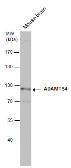 Anti-ADAMTS4 antibody [N3C2], Internal used in Western Blot (WB). GTX105125