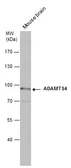 Anti-ADAMTS4 antibody [N3C2], Internal used in Western Blot (WB). GTX105125