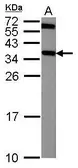 Anti-CRYM antibody [N1C3] used in Western Blot (WB). GTX105145