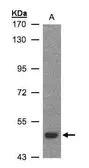 Anti-LBP antibody [N3C3] used in Western Blot (WB). GTX105154