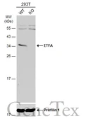 Anti-ETFA antibody used in Western Blot (WB). GTX105155