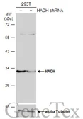 Anti-HADH antibody used in Western Blot (WB). GTX105167