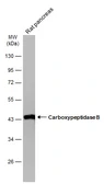 Anti-Carboxypeptidase B antibody [N1C1] used in Western Blot (WB). GTX105170