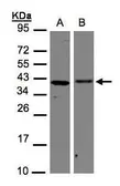 Anti-AIMP1 antibody used in Western Blot (WB). GTX105175