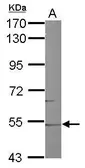 Anti-CYP46A1 antibody [N1C2] used in Western Blot (WB). GTX105183