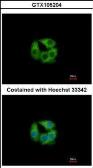 Anti-PCCB antibody [N2C3] used in Immunocytochemistry/ Immunofluorescence (ICC/IF). GTX105204