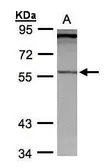Anti-PCCB antibody [N2C3] used in Western Blot (WB). GTX105204