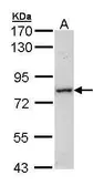 Anti-MTMR14 antibody used in Western Blot (WB). GTX105206
