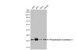 Anti-Phospholipid scramblase 1 antibody [N1C3] used in Western Blot (WB). GTX105225