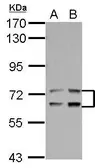 Anti-LTA4H antibody used in Western Blot (WB). GTX105239