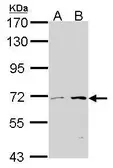 Anti-CROT antibody [N2C2], Internal used in Western Blot (WB). GTX105243